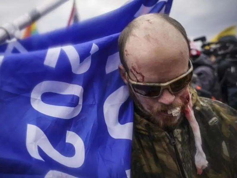 Ein verletzter Demonstrant am Rande der Proteste vor dem Kapitol.
