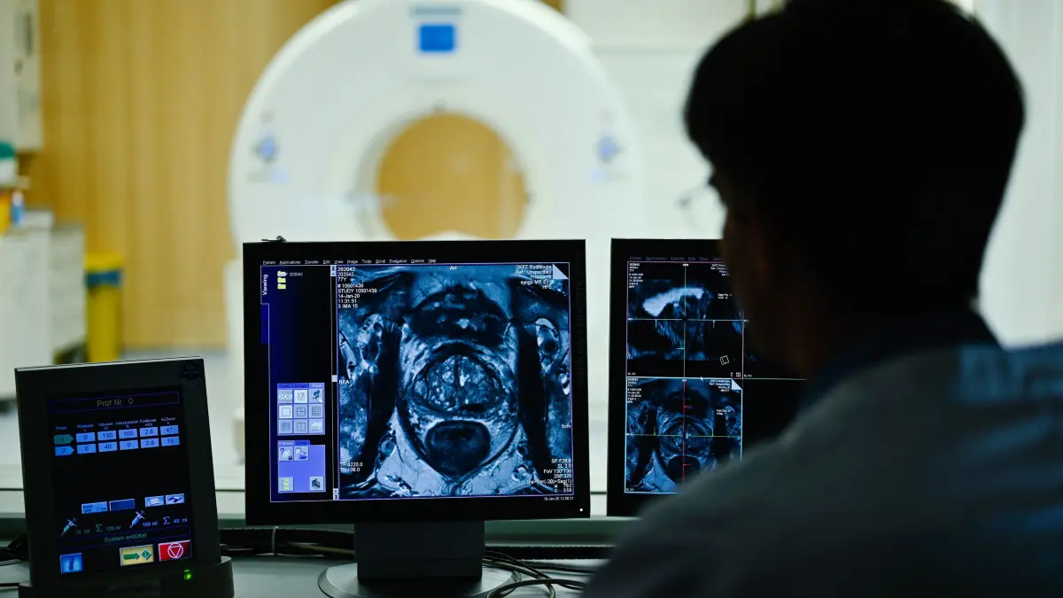 Ein Mitarbeiter betrachtet in einem Kontrollraum des Deutschen Krebsforschungszentrum (DKFZ) auf einem Monitor das Querschnittsbild einer Prostata. Nach Herz-Kreislauf-Erkrankungen ist Krebs weiterhin in Deutschland die zweithäufigste Todesursache.