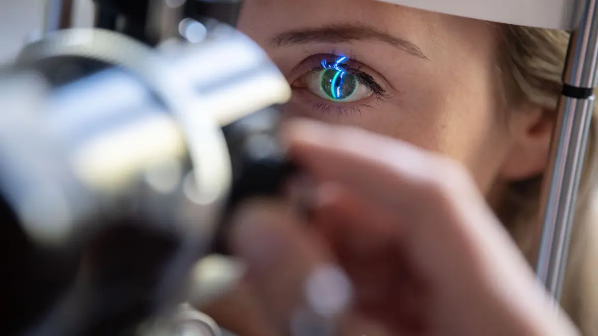 Ein Arzt untersucht das Auge einer Patientin: ARCHIV - Stellt Augenarzt oder Optiker fest, dass man eine Brille mit mehr als 6 Dioptrien benötigt oder beträgt etwa das Sehvermögen 30 Prozent oder weniger, bekommt man einen Zuschuss zur Brille von der Krankenkasse. (zu dpa: «Neue Brille: Wann gibt die Krankenkasse einen Zuschuss?») Foto: Marijan Murat/dpa/dpa-tmn - Honorarfrei nur für Bezieher des dpa-Themendienstes +++ dpa-Themendienst +++