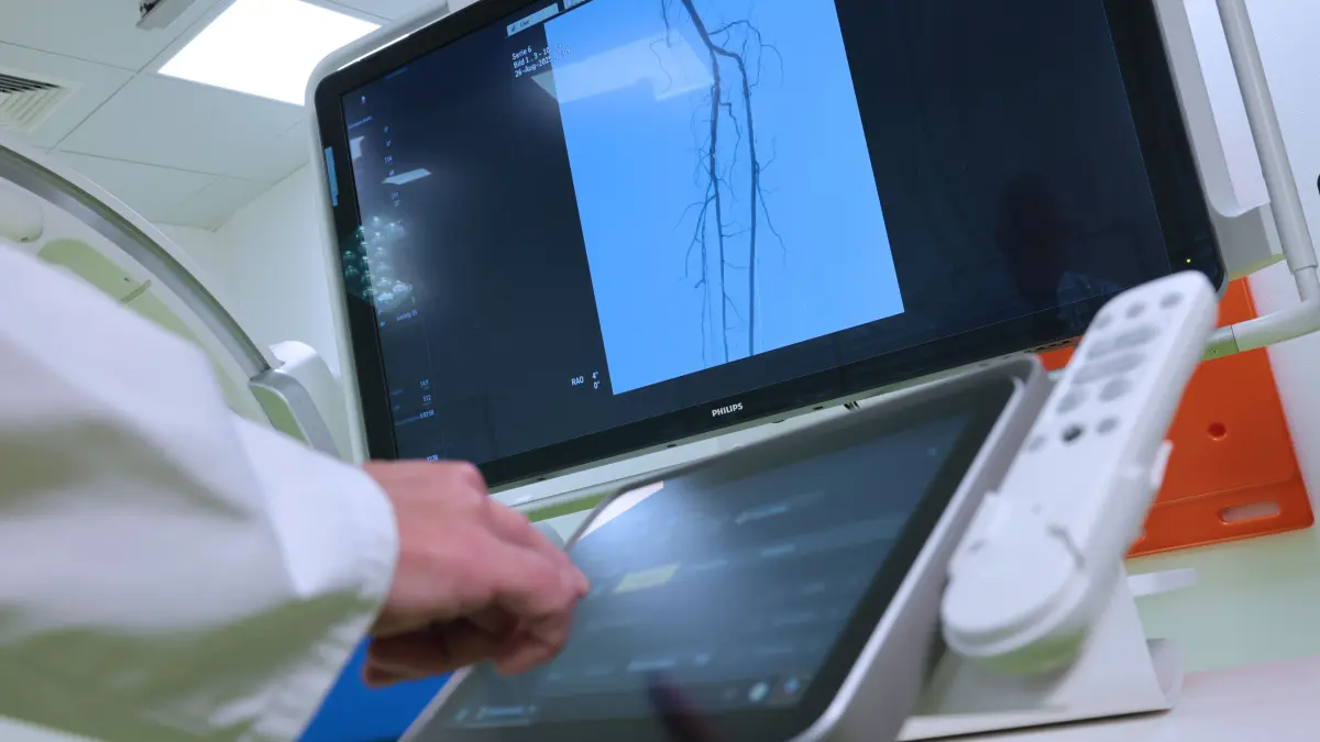 Die hochmoderne Angiographie-Anlage in den Sana Kliniken Niederlausitz macht feinste Gefäße sichtbar und behandelbar - ohne schädliche Kontrastmittel.