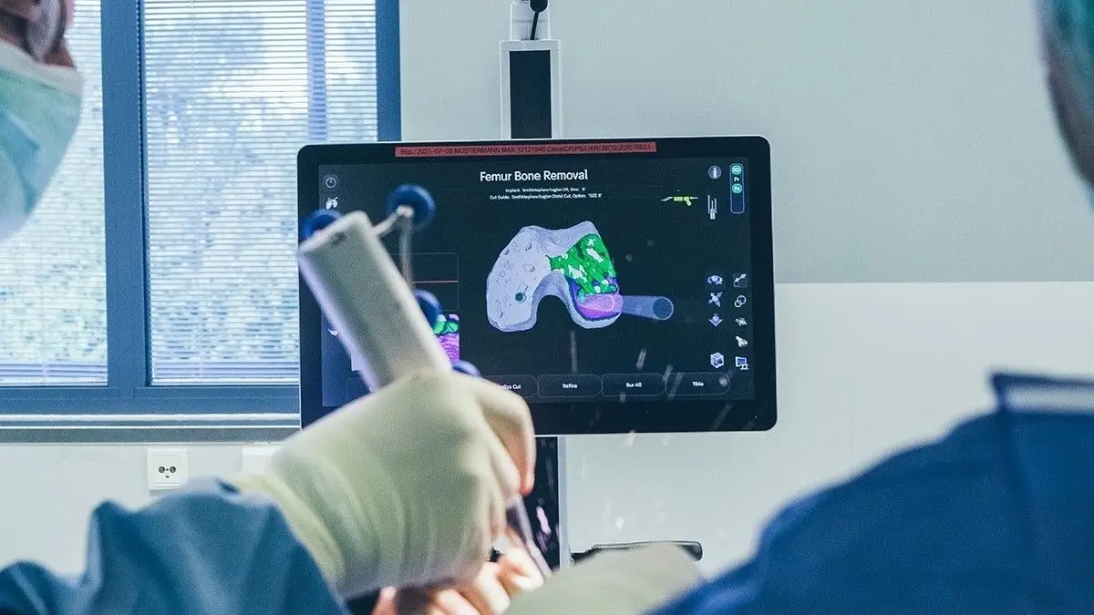 Robotisch-assistierter Knie-gelenkersatz. Die Fräsebene wird vom Roboter zehntelmillimetergenau vorgegeben.