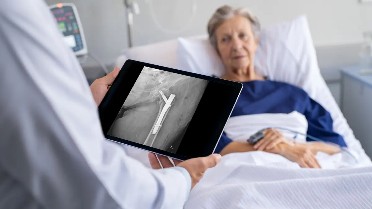 Im ATZ des Alb-Donau Klinikums Ehingen arbeiten verschiedene Berufsgruppen und Experten für denErhalt der Selbstständigkeit von Patientinnen und Patienten mit Knochenbrüchen.