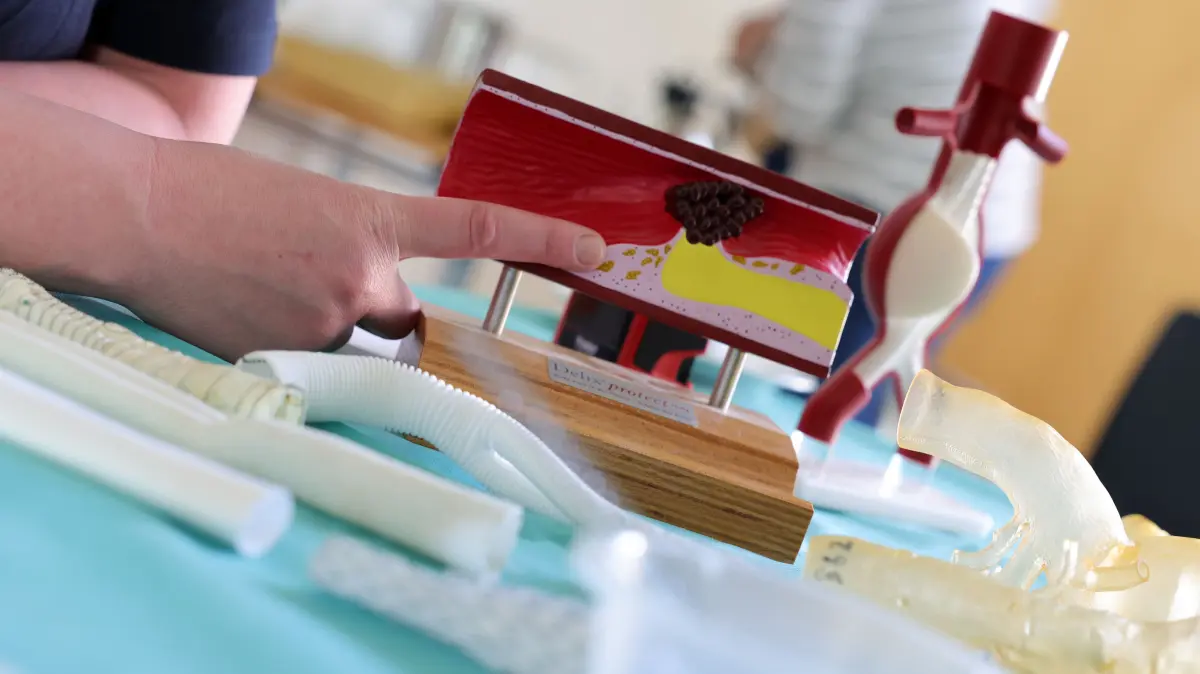 Rauchen, hohe Cholesterinwerte oder Bluthochdruck können Gefäße auf Dauer schädigen. Kalkablagerungen sorgen dafür, dass sich die Blutbahnen Stück für Stück verengen oder gänzlich verstopfen.